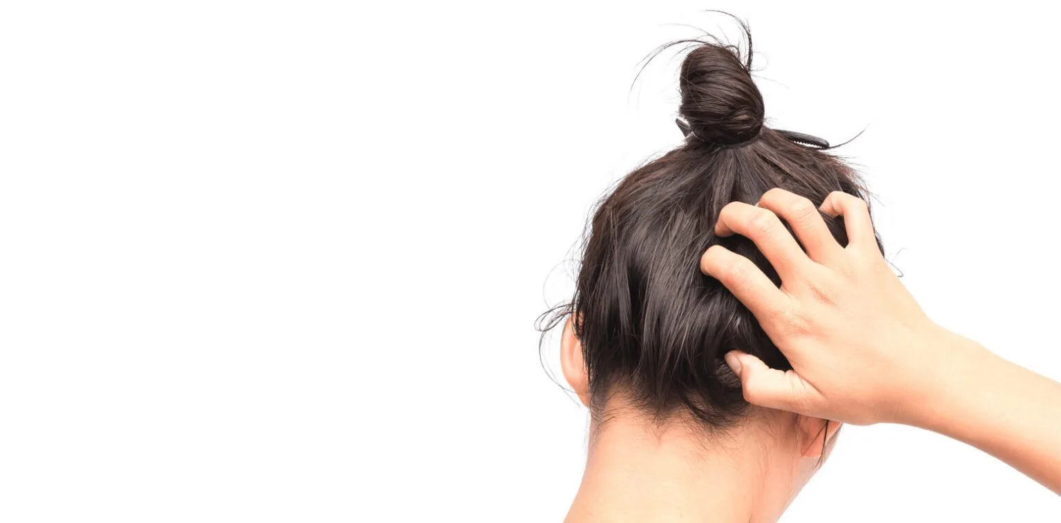 Oily-Hair-Cabello-Graso-SIMONE-TRICHOLOGY