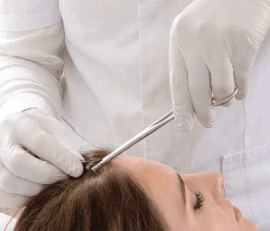 TRICHOGRAM-SIMONE TRICHOLOGY - Advanced Hair Solutions