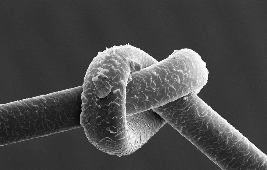 TRICHONODOSIS-SIMONE TRICHOLOGY